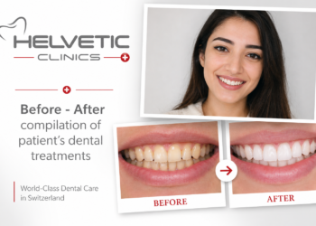 Dental Treatment Abroad Helvetic Clinics
