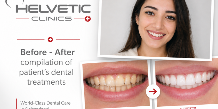 Dental Treatment Abroad Helvetic Clinics