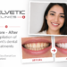 Dental Treatment Abroad Helvetic Clinics