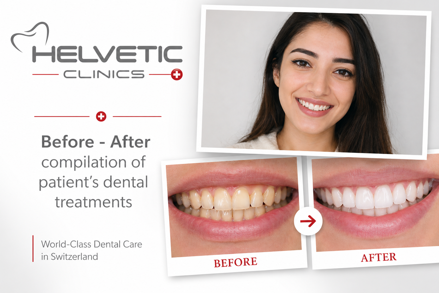 Dental Treatment Abroad Helvetic Clinics