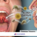 can allergies cause sore throat