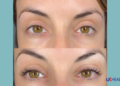 how long does a lash lift last