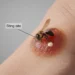 What Does a Bee Sting Look Like