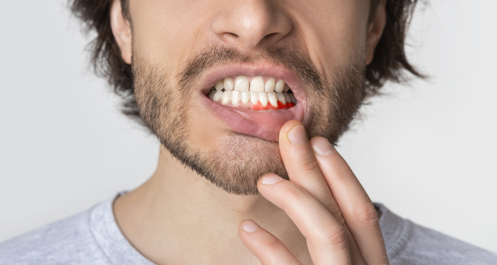 why is my gum swollen around one tooth in the back