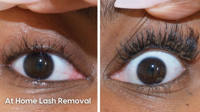 what is the fastest way to remove eyelash extensions at home