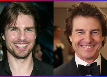 tom cruise teeth