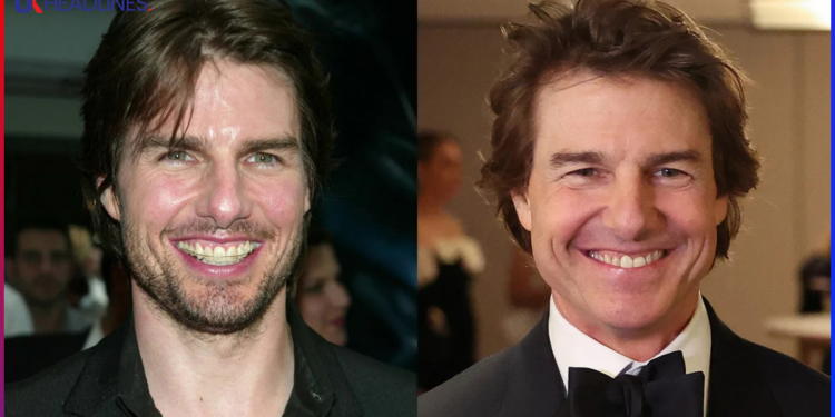 tom cruise teeth