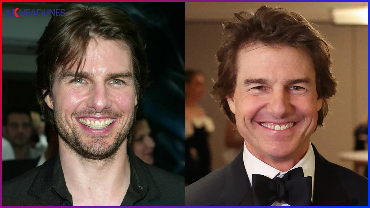 tom cruise teeth