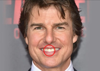tom cruise middle tooth