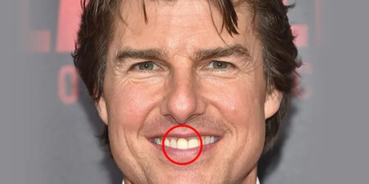 tom cruise middle tooth