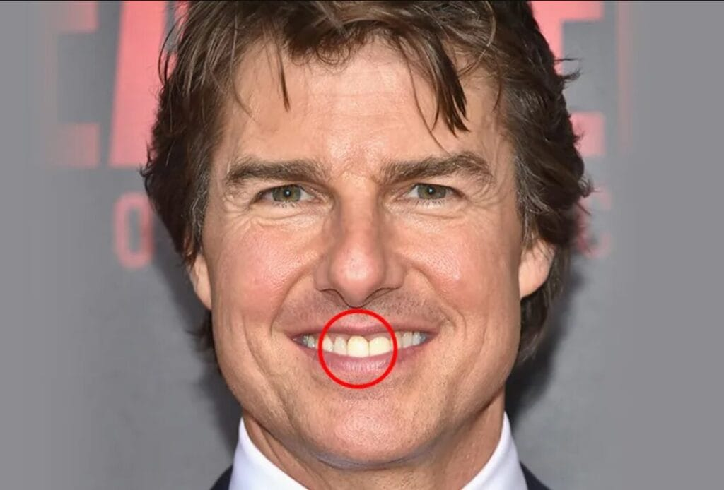 tom cruise middle tooth