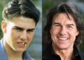 tom cruise teeth before and after