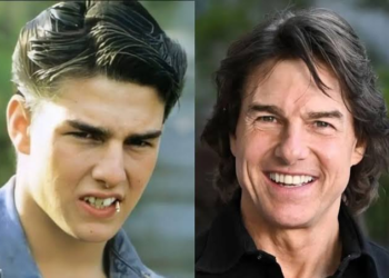 tom cruise teeth before and after