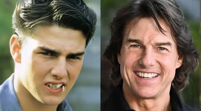 tom cruise teeth before and after