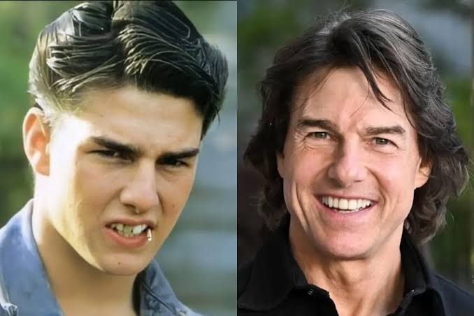 tom cruise teeth before and after