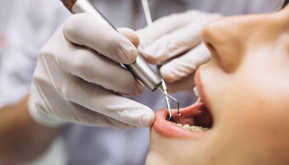 Why Your NHS Dentist Keeps Recommending ‘Private Extras’: What’s Actually Optional vs Medically Necessary in Southwell