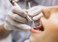 Why Your NHS Dentist Keeps Recommending ‘Private Extras’: What’s Actually Optional vs Medically Necessary in Southwell
