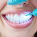 Teeth Whitening