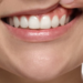 Teeth