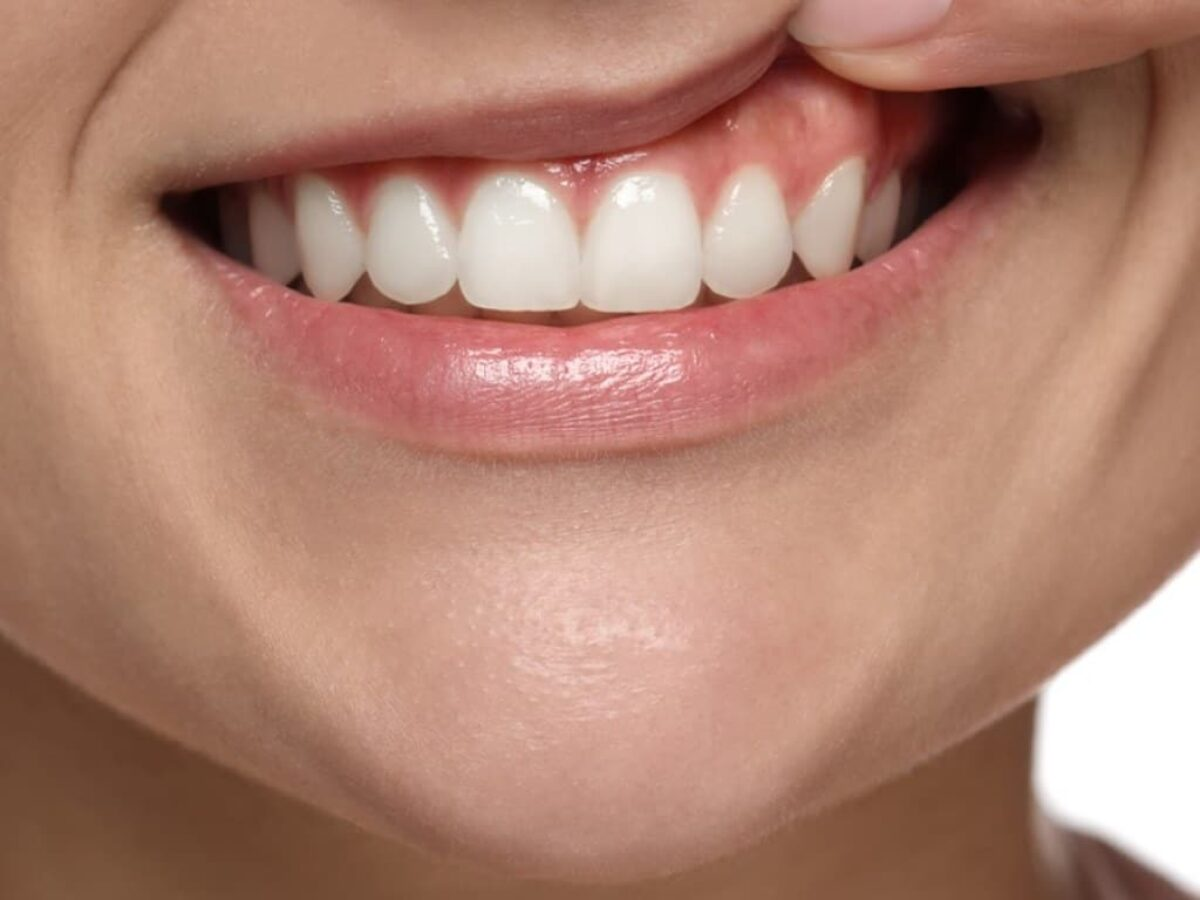 Teeth